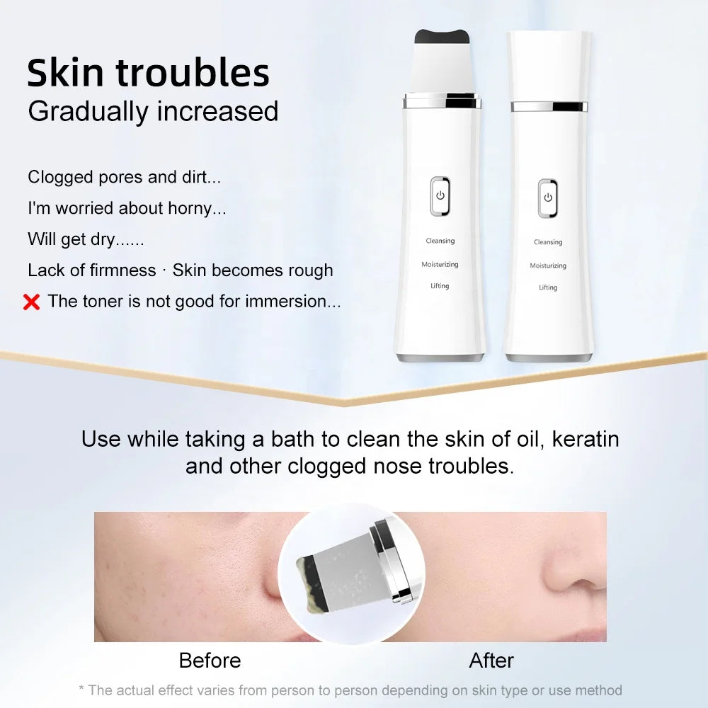 Beauty Product Professional Face Beauty Care Salon Skin Scrubber Facial Cleaner Lift Sonic Ultrasonic Skin Scrubber
