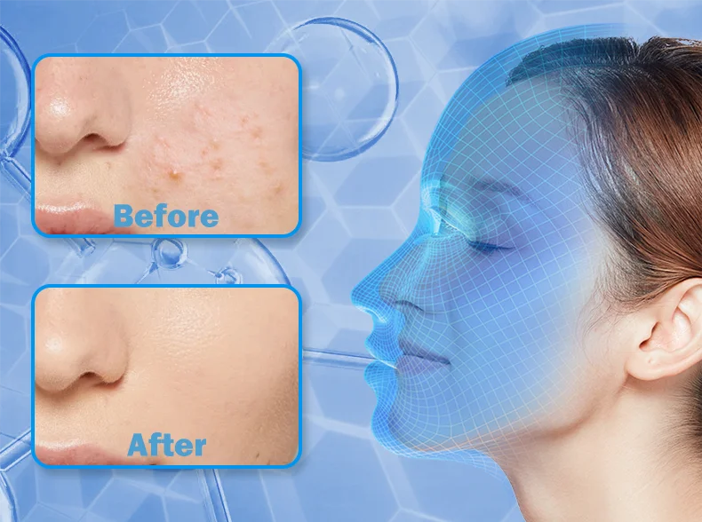 LED Photon Beauty Infrared Mask Instrument USB Electronic Mask Rejuvenation Lightens Fine Lines Brighten Skin Tone Repair Skin